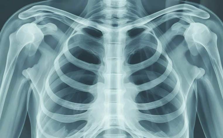 radio agression couteau hôpital insolite