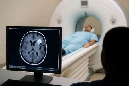 IRM cérébrale en salle d’examen, avec un patient et un écran affichant une anomalie évocatrice d’AVC silencieux