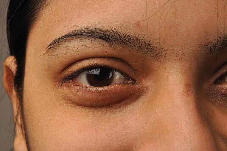 Gros plan horizontal d’un œil humain montrant nettement la pupille, l’iris et le limbe cornéen, éclairage naturel.