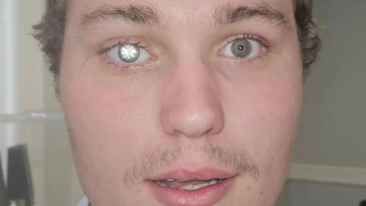 Homme Diamant Prothese