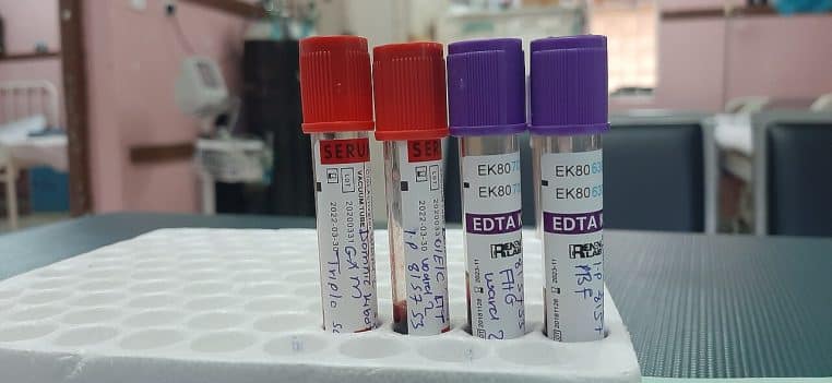 Quatre tubes de prélèvement sanguin étiquetés posés en laboratoire, symbolisant les analyses liées au risque cardiovasculaire.