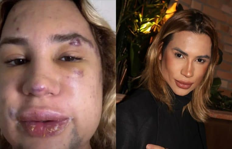 Junior Dutra, influenceur mode, meurt après une infection mortelle