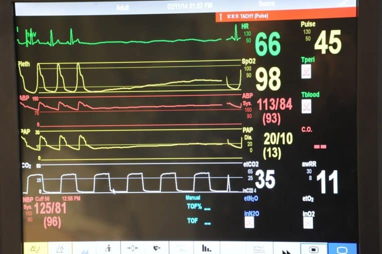 Écran hospitalier affichant tracé ECG, SpO2 et tension artérielle en temps réel.