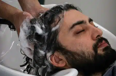 Syndrome du coiffeur