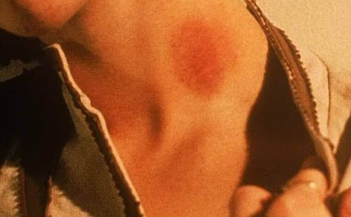 suçon adolescent actu