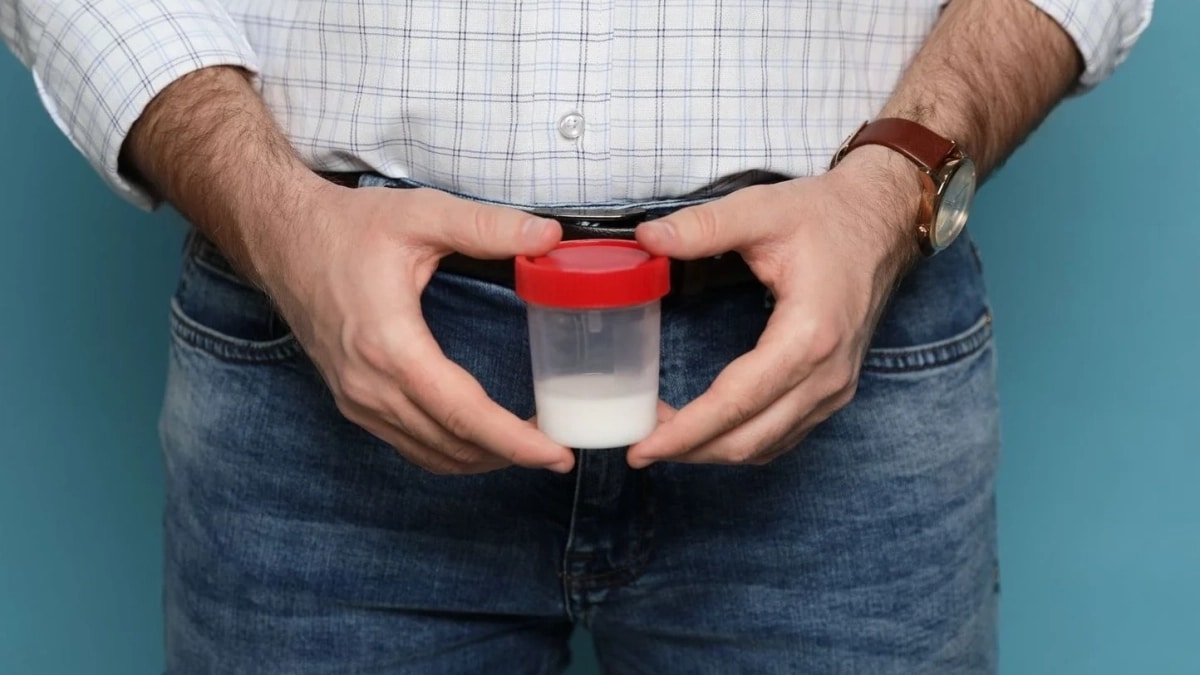 Banque de sperme Criteres