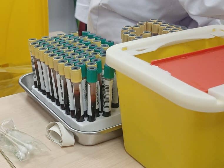 Rangée de tubes de sang rouges alignés dans un rack de laboratoire, symbolisant la répétition des tests sanguins au quotidien
