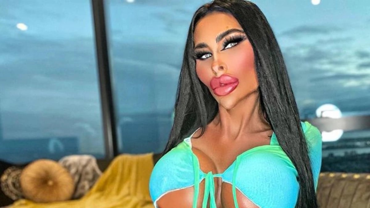 Influenceuse Chirurgie Extreme