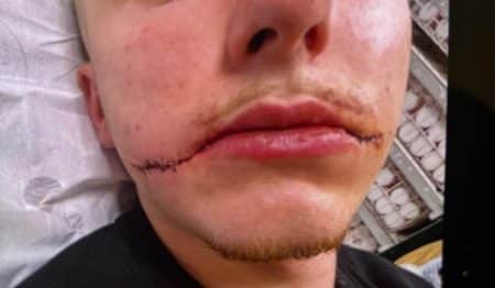 Agression de Killian, 20 ans