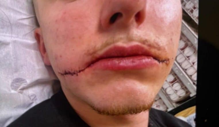 Agression de Killian, 20 ans