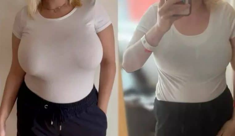 Lydia a subi une réduction mammaire