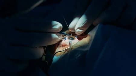 Femme Ver Oeil