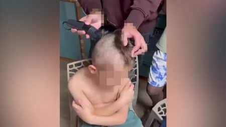 enfant rase apres pinitoin - copie