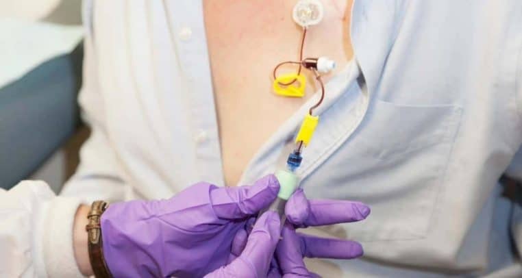 4 ans chimio cancer existe pas - copie