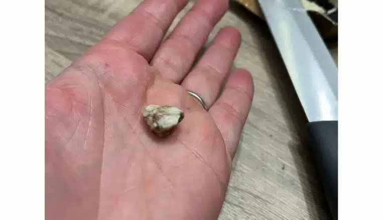 ENFANT trouve un caillou dans sa bucheee