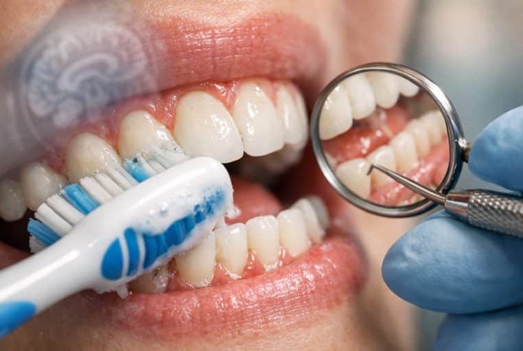 Gros plan d’un examen dentaire et du brossage, gencives nettes, évoquant la piste bouche-cerveau d’Alzheimer.