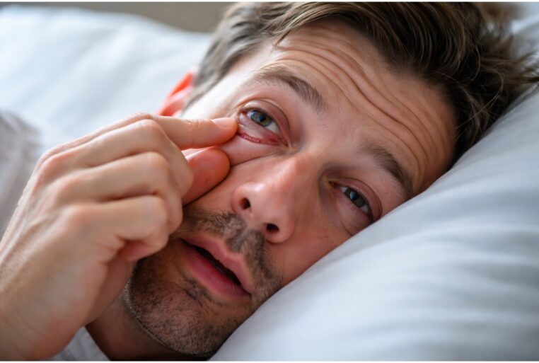 Syndrome des paupières lâches : un homme se réveille avec une paupière supérieure très relâchée et un œil rouge irrité.