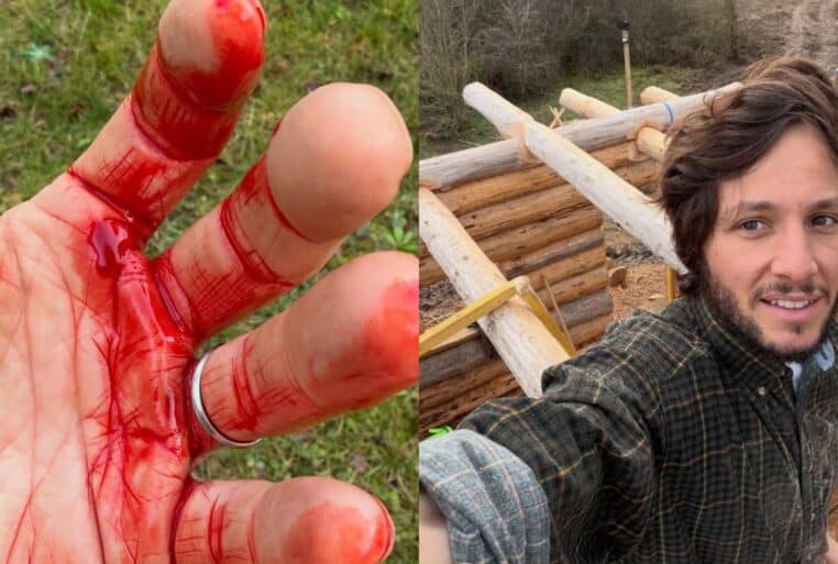 Vianney sur le chantier de sa cabane, avec un gros plan de sa main ensanglantée (Instagram).