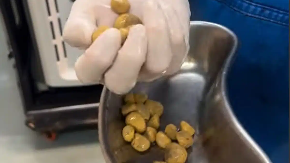 Calculs Renaux Coca Cola