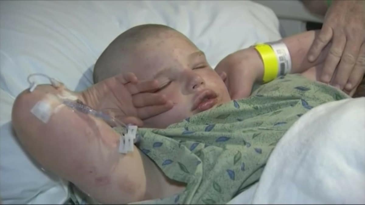 Enfant Attaque Abeilles