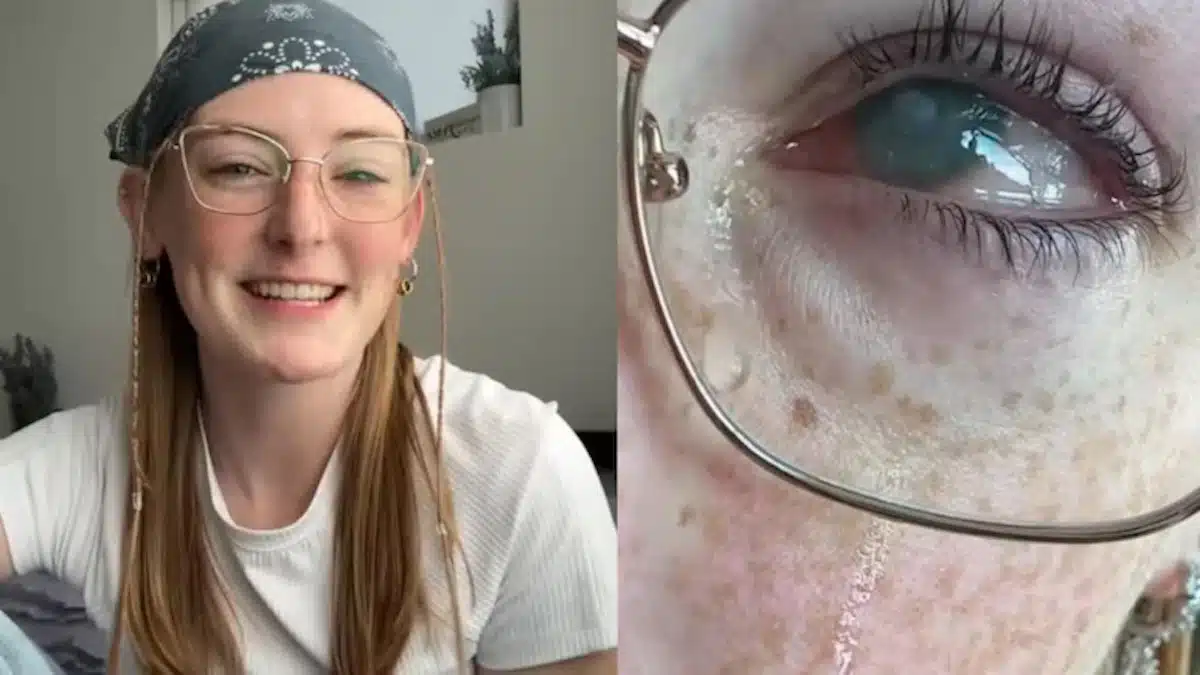 PERD LA vue a cause de ses lentilles - copie