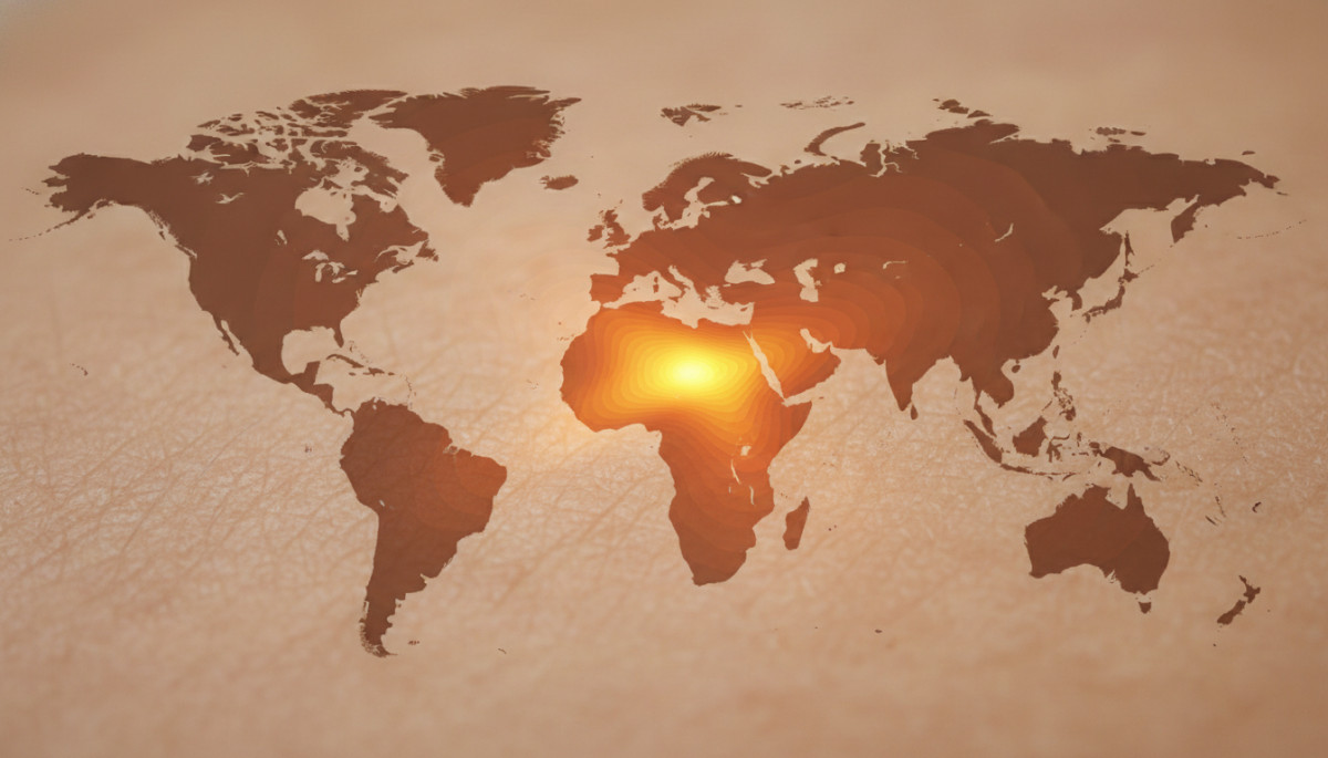 Carte mondiale de distribution du sinus préauriculaire