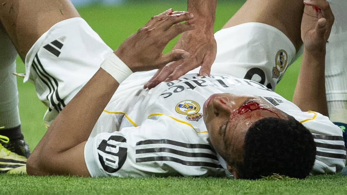 Kylian Mbappé au sol, le visage en sang, après un coup de coude reçu dans la surface de réparation lors de Real Madrid - Gérone