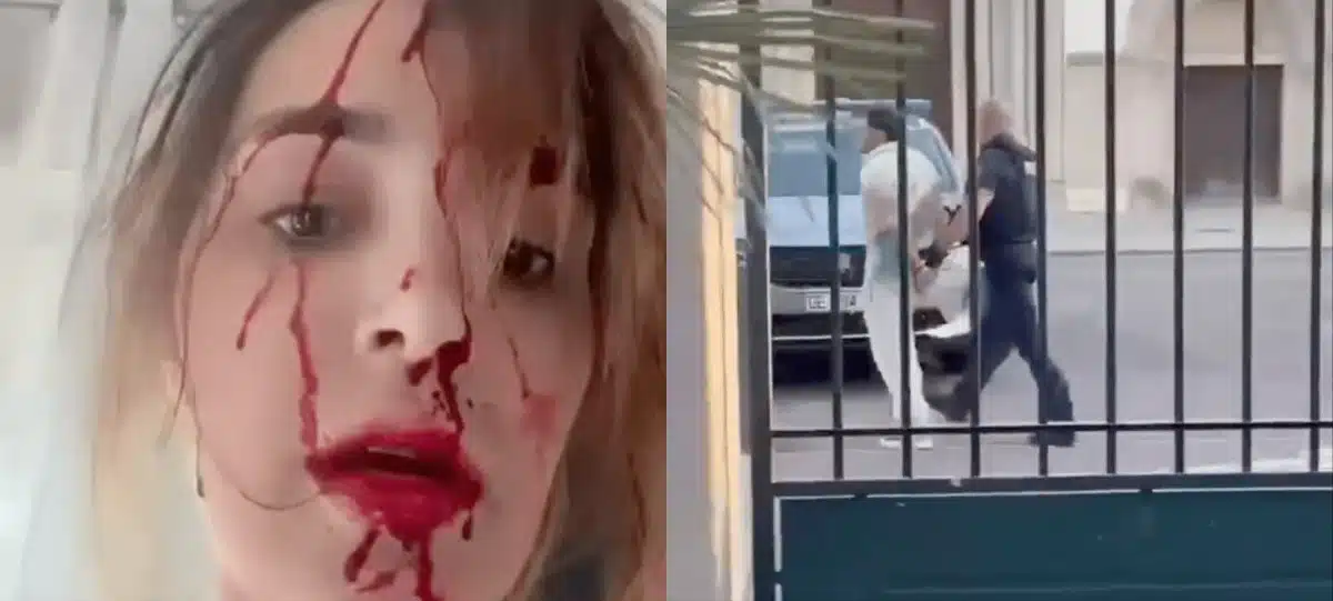 Cannes 2026 : Miss Venezuela filme son visage en sang et accuse son styliste… la vidéo glaçante