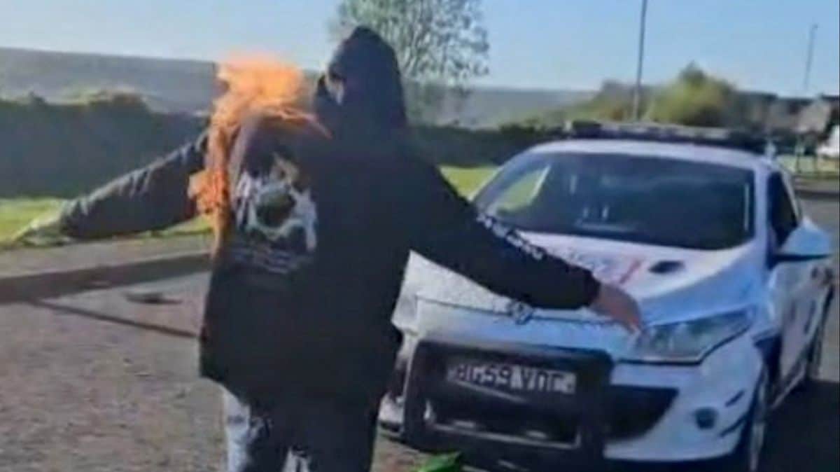 En feu et le pénis attaché à une voiture de 2 tonnes : « Les gens pensent que je suis fou »