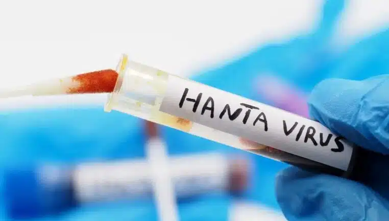 hantavirus un medecin alerte - copie