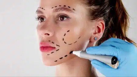 Ces opérations de chirurgie esthétique que des milliers de patients regrettent amèrement selon les chirurgiens