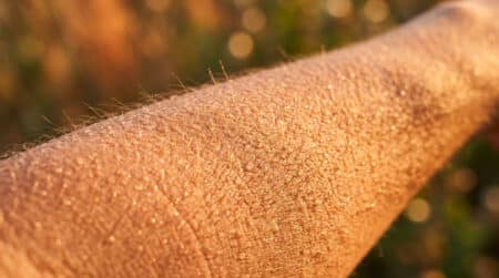 Gros plan sur la peau d'un avant-bras éclairée en lumière dorée