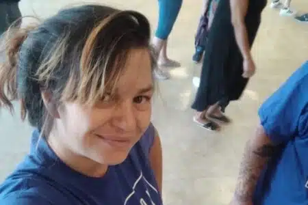 « Son visage a été défiguré » : une femme enceinte de jumeaux attaquée par un pitbull, l'issue est glaçante