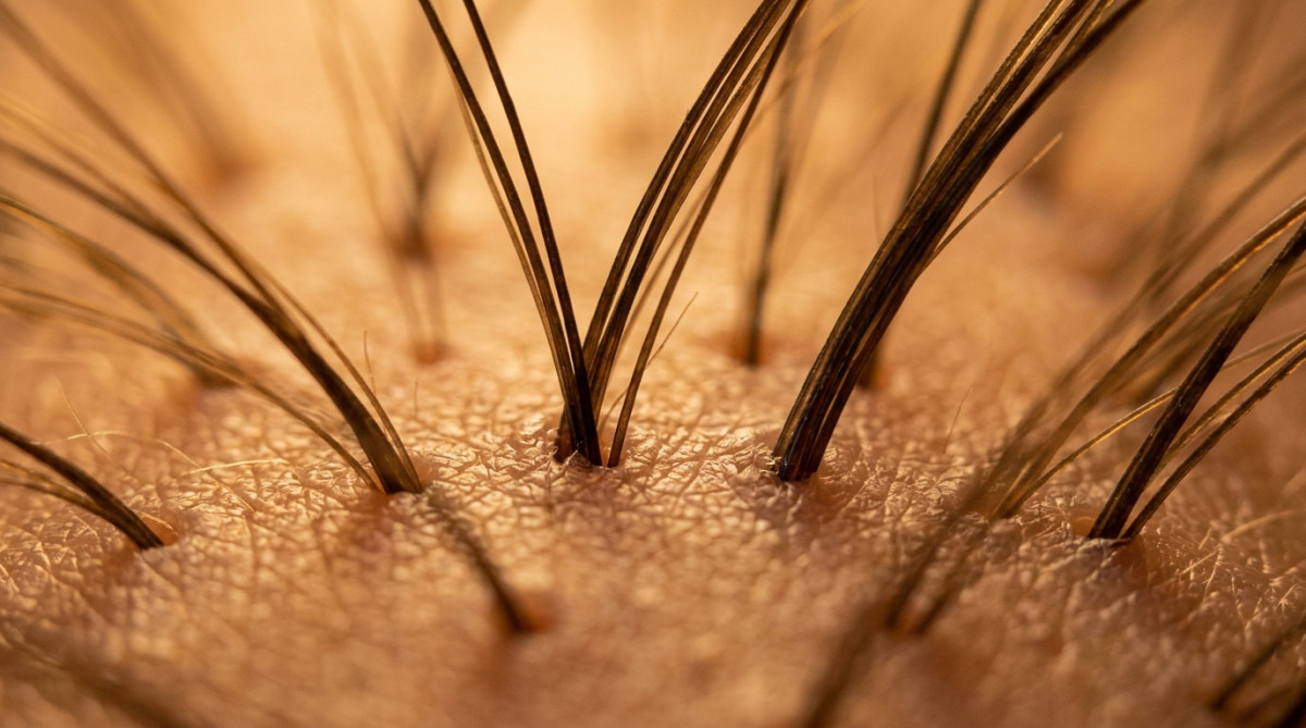 Gros plan macro sur des racines de cheveux