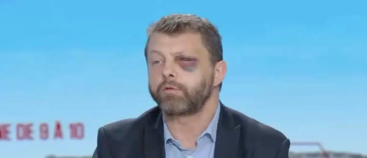 « Je vais te tuer sale pédé » : un policier agressé au sortir d'un bar gay raconte son cauchemar à Paris